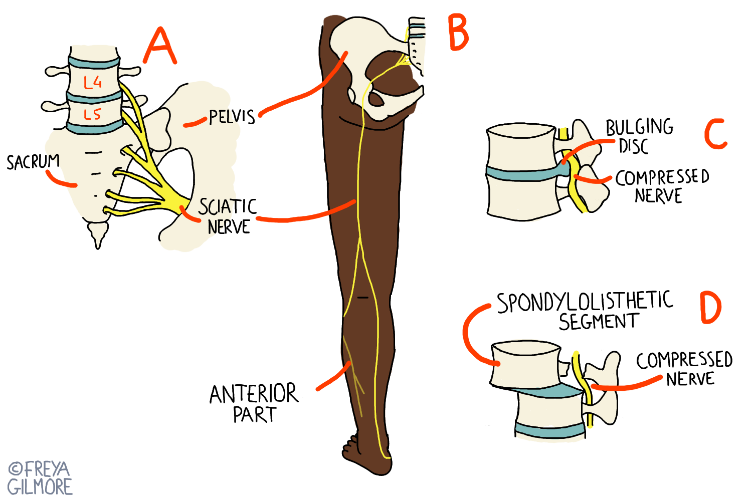 602afae63b81f-radicular-3429680082.png